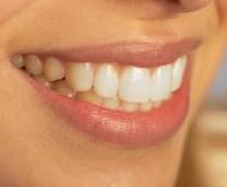 Sourires 4