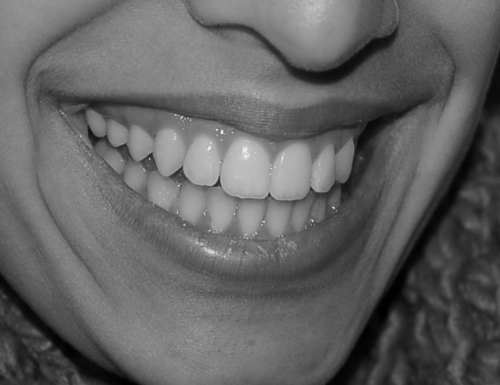 Sourires 2